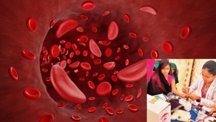 सिकलसेल रोकथाम के लिए नासिक में ‘अरुणोदय’ विशेष जांच अभियान;15 जनवरी से 7 फरवरी तक चलेगी जांच मुहिम