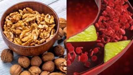 नसों में जमा कोलेस्ट्रॉल मक्खन की तरह पिघलेगा! बस जान लें अखरोट खाने का ये सही तरीका