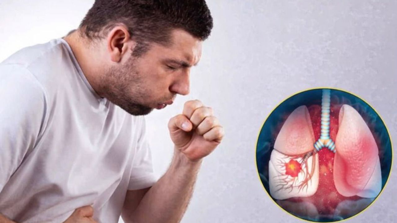 अमरावती में तेजी से बढ़ रहे कैंसर के मामले, तंबाकू बना मुख्य कारण, 63% आबादी तंबाकू की लत में