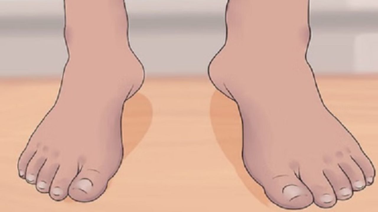 Chandrapur News: संक्रमण की श्रृंखला रोकने के लिए दवा अभियान, हाथीपांव उन्मूलन हेतु विशेष पहल