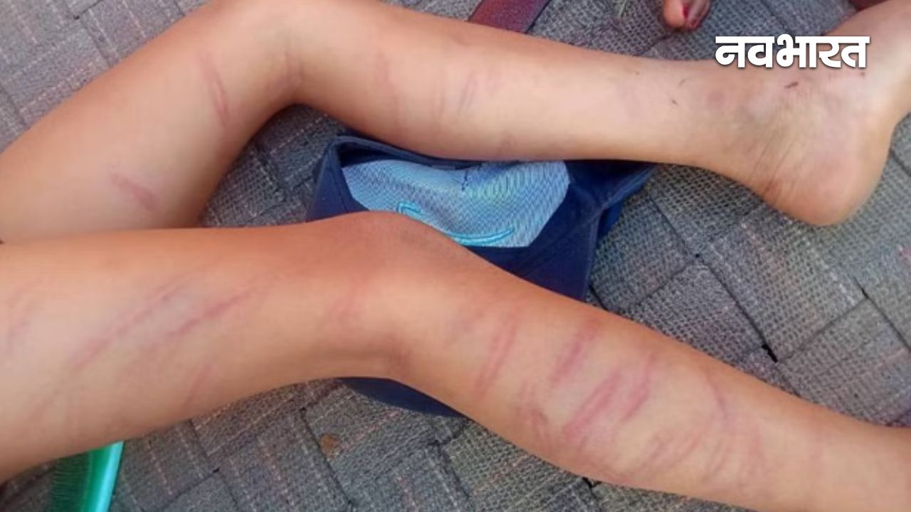 होमवर्क न करने पर 10 साल के मासूम को मारे 105 डंडे, स्कूल टीचर ने दी ‘तालिबानी’ सजा